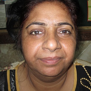 Realistic Eye Care Patient