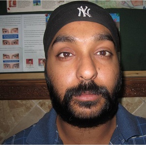 Manpreet Singh Patient Realistic eye care
